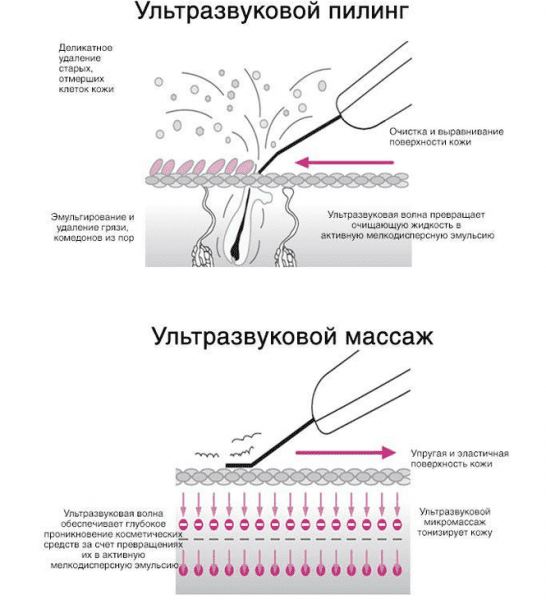 30719 Аппарат для ультразвуковой чистки лица Bio Sonic 770 Beauty Star  - Вид №7